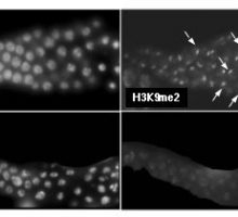 2 over 2 black and white photomicrograph panels